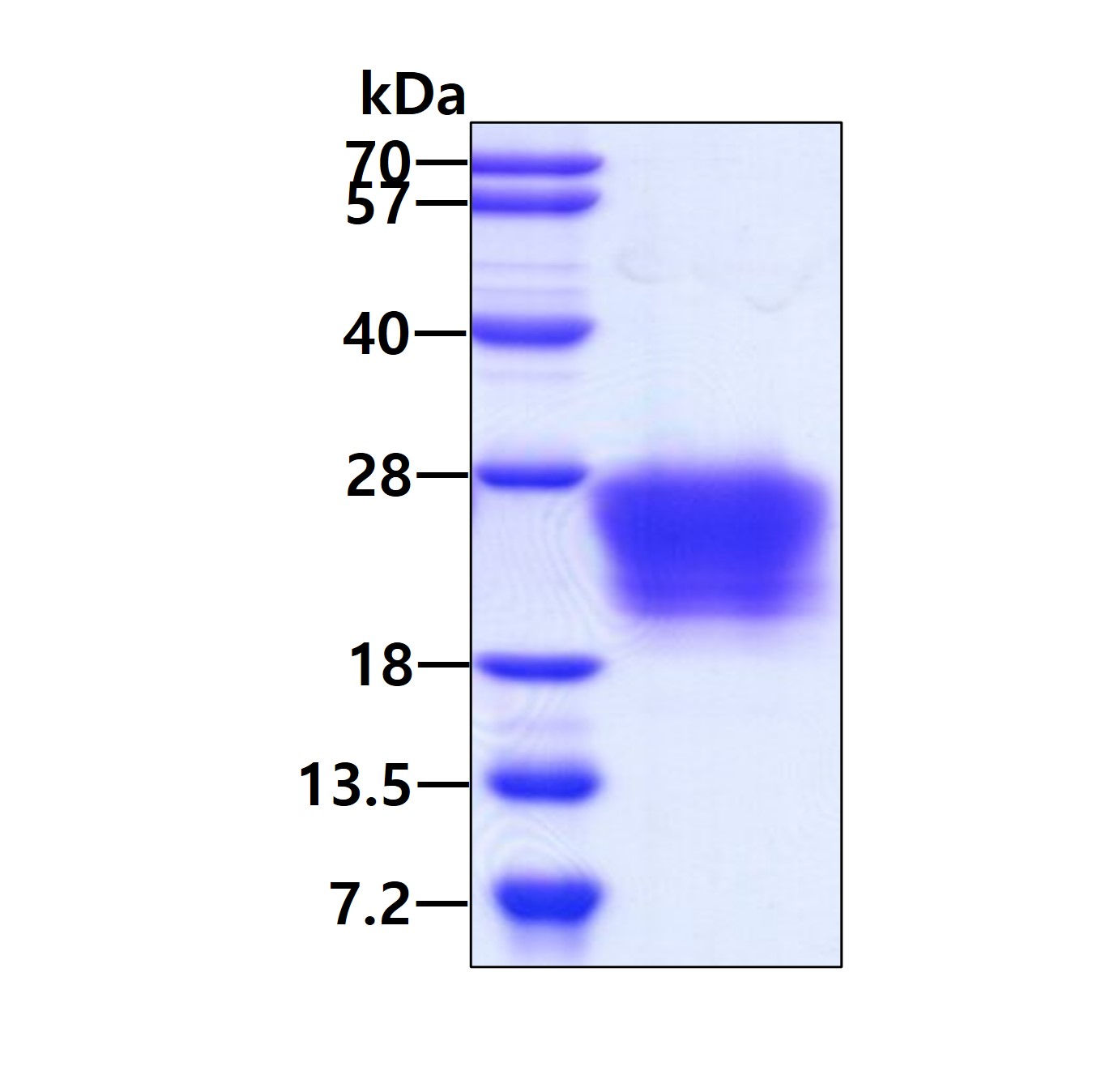 Recombinant human Pl...
