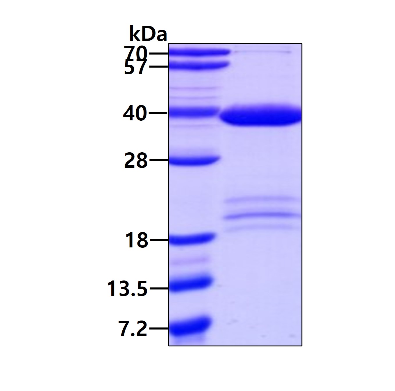 Recombinant mouse IG...