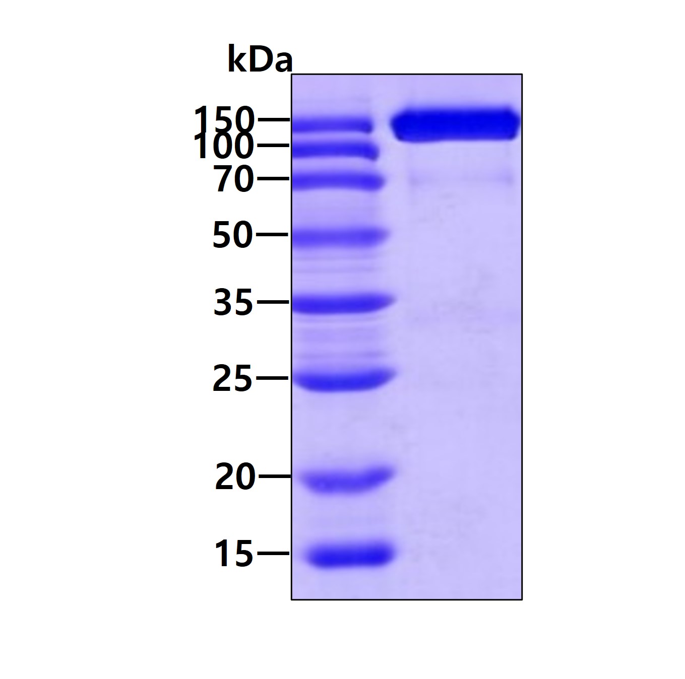 Recombinant human se...