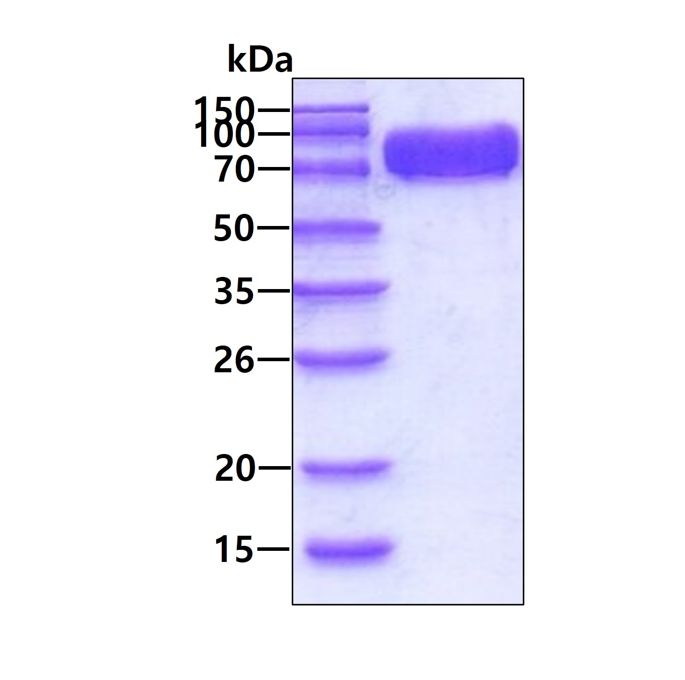 Recombinant mouse Ep...