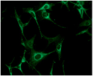ICC/IF analysis of AK3 in U87MG cells line, stained with DAPI (Blue) for nucleus staining and monoclonal anti-human   AK3 antibody (1:100) with goat anti-mouse IgG-Alexa fluor 488 conjugate (Green).