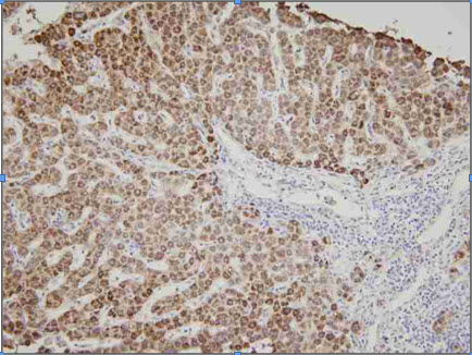 Human liver tissue was incubated with anti-human Ak3 (1:100) for 2 hours at room temperature. Slide was then washed in PBS, and was incubated in avidin biosystem anti-rabbit labeled polymer for 30 min at RT. Enzyme detection was performed with DAB chromo-gen. 