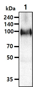 Tissue lysates of mouse brain(30ug) were resolved by SDS-PAGE, transferred to NC membrane and probed with anti-human APP (1:1000). Proteins were visualized using a goat anti-mouse secondary antibody conjugated to HRP and an ECL detection system.