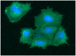 ICC/IF analysis of BHMT in Hep3B cells line, stained with DAPI (Blue) for nucleus staining and monoclonal anti-human BHMT antibody (1:100) with goat anti-mouse IgG-Alexa fluor 488 conjugate (Green).