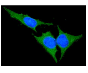 ICC/IF analysis of BID in HeLa cells line, stained with DAPI (Blue) for nucleus staining and monoclonal anti-human BID antibody (1:100) with goat anti-mouse IgG-Alexa fluor 488 conjugate (Green).