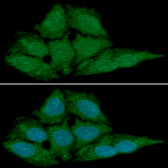 ICC/IF analysis of BLyS in HeLa cells line, stained with DAPI (Blue) for nucleus staining and monoclonal anti-human BLyS antibody (1:100) with goat anti-mouse IgG-Alexa fluor 488 conjugate (Green)