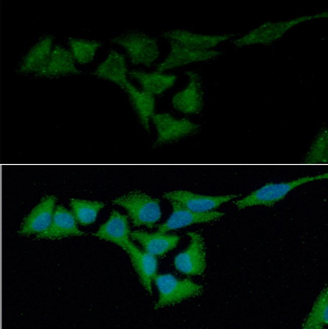 ICC/IF analysis of Crystallin alpha B in HeLa cells line, stained with DAPI (Blue) for nucleus staining and monoclonal anti-human Crystallin alpha B antibody (1:100) with goat anti-mouse IgG-Alexa fluor 488 conjugate (Green).