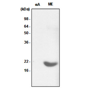 Recombinant crystallin alpha A (alphaA) and the extract of mouse eye (ME) were resolved by SDS-PAGE, transferred to PVDF membrane and probed with anti-human crystallin alpha B antibody (1:1,000). Proteins were visualized using a goat anti-mouse secondary antibody conjugated to HRP and an ECL detection system.