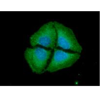 ICC/IF analysis of CD73 in LNCaP cells line, stained with DAPI (Blue) for nucleus staining and monoclonal anti-human CD73 antibody (1:100) with goat anti-mouse IgG-Alexa fluor 488 conjugate (Green)