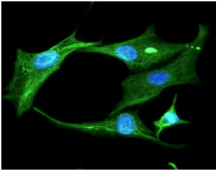 ICC/IF analysis of Clusterin in U87MG cells line, stained with DAPI (Blue) for nucleus staining and monoclonal anti-human Clusterin antibody (1:100) with goat anti-mouse IgG-Alexa fluor 488 conjugate (Green).