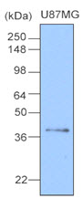 Cell lysates of U87MG(20ug) were resolved by SDS-PAGE, transferred to NC membrane and probed with anti-human Clusterin (1:1000). Proteins were visualized using a goat anti-mouse secondary antibody conjugated to HRP and an ECL detection system.