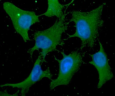 ICC/IF analysis of Cofilin1 in HeLa cells line, stained with DAPI (Blue) for nucleus staining and monoclonal anti-human Cofilin1 antibody (1:100) with goat anti-mouse IgG-Alexa fluor 488 conjugate (Green).