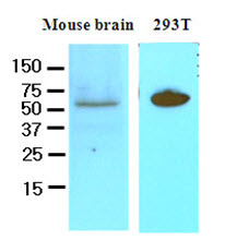 Cell lysates of mouse brain and 293T (50ug) were resolved by SDS-PAGE, transferred to NC membrane and probed with anti-human DACT3 (1:250). Proteins were visualized using a goat anti-mouse secondary antibody conjugated to HRP and an ECL detection system.