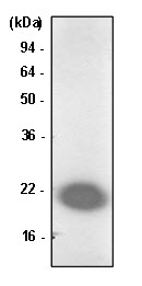Jurkat cell lysate was resolved by SDS-PAGE, transferred to PVDF membrane and probed with anti-human Park7/DJ-1 antibody (1:1000). Protein was visualized using a goat anti-mouse secondary antibody conjugated to HRP and an ECL detection system. 