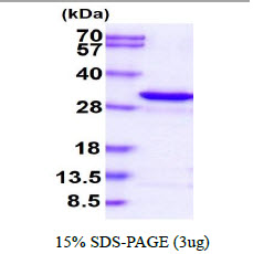 3ug by SDS-PAGE under reducing condition and visualized by coomassie blue stain.