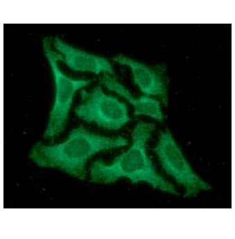 ICC/IF analysis of EPM2A in HeLa cells line, stained with DAPI (Blue) for nucleus staining and monoclonal anti-human     EPM2A antibody (1:100) with goat anti-mouse IgG-Alexa fluor 488 conjugate (Green).