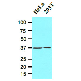 Cell lysates of HeLa and 293T (20ug) were resolved by SDS-PAGE, transferred to NC membrane and probed with anti-human EPM2A (1:1000). Proteins were visualized using a goat anti-mouse secondary antibody conjugated to HRP and an ECL detection system.