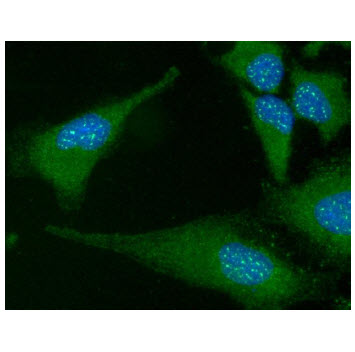 ICC/IF analysis of FADD in HeLa cells line, stained with DAPI (Blue) for nucleus staining and monoclonal anti-human FADD antibody (1:100) with goat anti-mouse IgG-Alexa fluor 488 conjugate (Green).