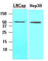 Cell lysates of LNCap, Hep3B (30ug) were resolved by SDS-PAGE, transferred to NC membrane and probed with anti-human ACOT11 (1:1000). Proteins were visualized using a goat anti-mouse secondary antibody conjugated to HRP and an ECL detection system.