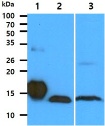 The Recombinant protein (50ng) and Cell lysates (40ug) were resolved by SDS-PAGE, transferred to PVDF membrane and probed with anti-human FABP1 antibody (1:1000). Proteins were visualized using a goat anti-mouse secondary antibody conjugated to HRP and an ECL detection system.Lane 1.: FABP1 Recombinant proteinLane 2.: HepG2 cell lysateLane 3.: Liver tissues lysate