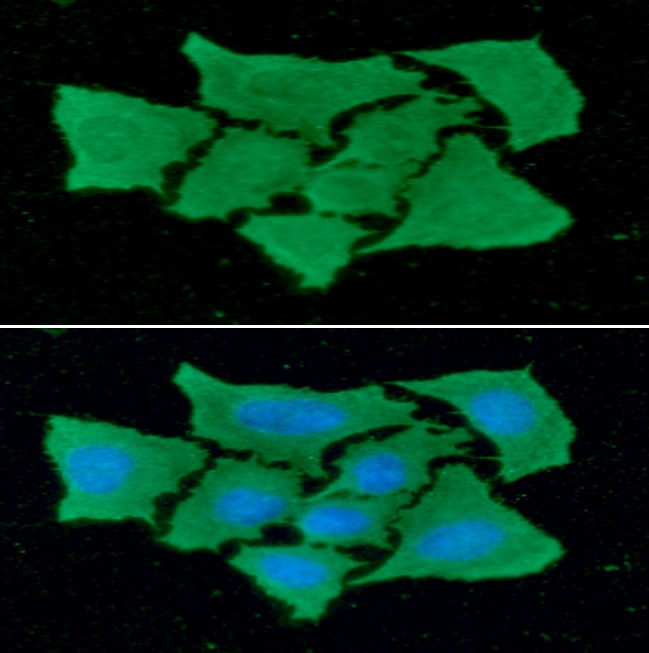 ICC/IF analysis of FABP4 in HeLa cells line, stained with DAPI (Blue) for nucleus staining and monoclonal anti-human FABP4 antibody (1:100) with goat anti-mouse IgG-Alexa fluor 488 conjugate (Green).