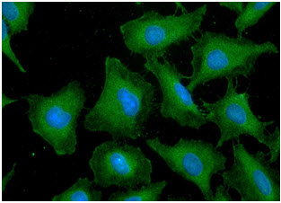 ICC/IF analysis of GST in HeLa cells line, stained with DAPI (Blue) for nucleus staining and monoclonal anti-human   GST antibody (1:100) with goat anti-mouse IgG-Alexa fluor 488 conjugate (Green).