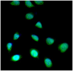 ICC/IF analysis of SET7/9 in HeLa cells line, stained with DAPI (Blue) for nucleus staining and monoclonal anti-human SET7/9 antibody (1:100) with goat anti-mouse IgG-Alexa fluor 488 conjugate (Green).
