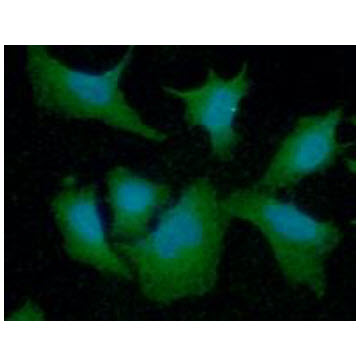 ICC/IF analysis of HSP70 in A549 cells line, stained with DAPI (Blue) for nucleus staining and monoclonal anti-human HSP70 antibody (1:100) with goat anti-mouse IgG-Alexa fluor 488 conjugate (Green).