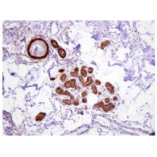 Paraffin embedded sections of human eccrine gland were incubated with anti-human Hsp70 (1:100) for 2 hours at room temperature. Antigen retrieval was performed in 0.1M sodium citrate buffer and detected using Diaminobenzidine (DAB)