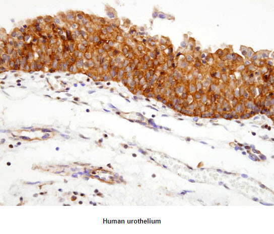 Paraffin embedded sections of human urothelium were incubated with anti-human Hsp90 (1:100) for 2 hours at room temperature. Antigen retrieval was performed in 0.1M sodium citrate buffer and detected using Diaminobenzidine (DAB)