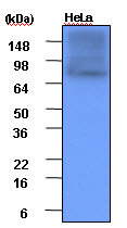 Cell lysates of HeLa(each 20ug) were resolved by SDS-PAGE, transferred to PVDF membrane and probed with anti-human Hsp90 (1:1,000). Proteins were visualized using a goat anti-mouse secondary antibody conjugated to HRP and an ECL detection system.