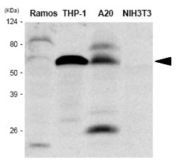 The extracts of Ramos, THP-1, A20 and NIH3T3 were resolved by SDS-PAGE, transferred to PVDF membrane and probed with anti-human IRF-5 antibody (1:1,000). Proteins were visualized using a goat anti-mouse secondary antibody conjugated to HRP and an ECL detection system.