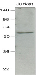 Cell lysates of Jurkat (40ug) were resolved by SDS-PAGE, transferred to NC membrane and probed with anti-human IRF-7 (1:1,000). Proteins were visualized using a goat anti-mouse secondary antibody conjugated to HRP and an ECL detection system.