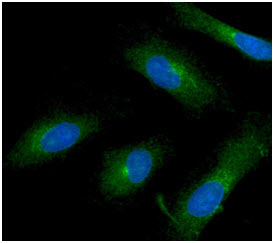 ICC/IF analysis of ISG15 in HeLa cells line, stained with DAPI (Blue) for nucleus staining and monoclonal anti-human ISG15  antibody (1:100) with goat anti-mouse IgG-Alexa fluor 488 conjugate (Green).
