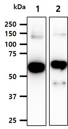 Recombinant protein MBP-tagged BCDEF, TPD52 and MAGEA3(each 20ng) were resolved by SDS-PAGE, transferred to PVDF membrane and probed with anti-MBP (1:1,000). Proteins were visualized using a goat anti-mouse secondary antibody conjugated to HRP and an ECL detection system.