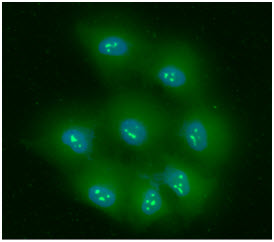 ICC/IF analysis of NPM in HeLa cells line, stained with DAPI (Blue) for nucleus staining and monoclonal anti-human NPM antibody (1:100) with goat anti-mouse IgG-Alexa fluor 488 conjugate (Green).