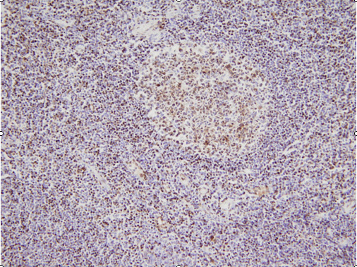 This image shows paraffin-embedded human palatine tonsil tissue sample stained with anti-NPM antibody (5E3) at 1:100 dilution.