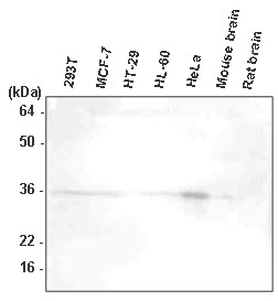 The extracts of 293T, MCF7, HT-29, HL-60, HeLa, mouse brain, and rat brain were resolved by SDS-PAGE, transferred to PVDF membrane and probed with anti-human HtrA2/Omi antibody (1:1,000). Proteins were visualized using a goat anti-mouse secondary antibody conjugated to HRP and an ECL detection system.