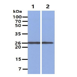 The Cell and Tissue lysates (40ug) were resolved by SDS-PAGE, transferred to PVDF membrane and probed with anti-human PGP9.5 antibody (1:1000). Proteins were visualized using a goat anti-mouse secondary antibody conjugated to HRP and an ECL detection system.Lane 1.: Mouse Brain lysate Lane 2.: U87-MG cell lysate 