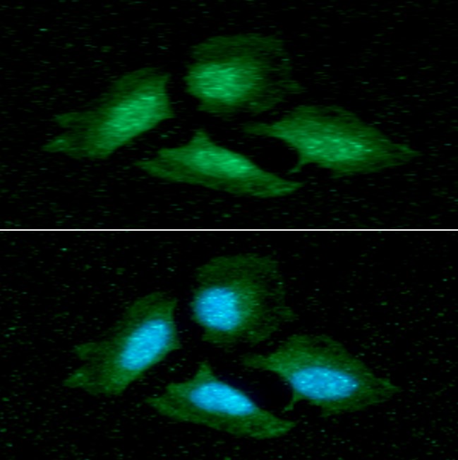 ICC/IF analysis of PPP1CA in HeLa cells line, stained with DAPI (Blue) for nucleus staining and monoclonal anti-human   PPP1CA antibody (1:100) with goat anti-mouse IgG-Alexa fluor 488 conjugate (Green).