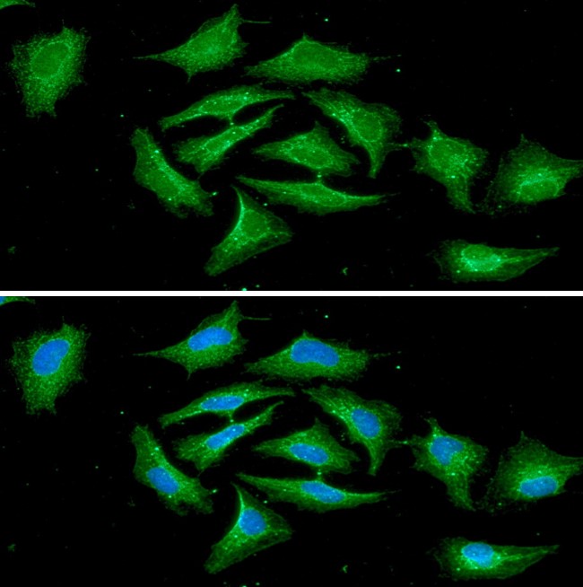 A431 cells were labeled with anti-RASSF1A (clone 3F3) mAb, and detection was using a biotinylated secondary antibody and Texas-red conj streptavidin.ICC/IF analysis of RASSF1A in HeLa cells line, stained with DAPI (Blue) for nucleus staining and monoclonal anti-human   RASSF1A antibody (1:100) with goat anti-mouse IgG-Alexa fluor 488 conjugate (Green).