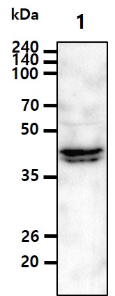 Cell lysates (40ug) were resolved by SDS-PAGE, transferred to PVDF membrane and probed with anti-human RASSF1A (1:500). Proteins were visualized using a goat anti-mouse secondary antibody conjugated to HRP and an ECL detection system.Lane 1. : HeLa cell lysate The Cell lysates (5ug) were resolved by SDS-PAGE, transferred to PVDF membrane and probed with anti-human RASSF1A antibody (1:500). Proteins were visualized using a goat anti-mouse secondary antibody conjugated to HRP and an ECL detection system.Lane 1.: 293T cell lysateLane 2.: RASSF1A Transfected 293T cell lysate