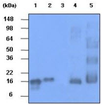 The recombinant human synuclein family (alpha-,beta- and gamma-) (each 20ng), Mouse brain and Rat brain (30ug) were resolved by SDS-PAGE, transferred to PVDF membrane and probed with anti-human alpha,beta-synuclein (1:1000). Proteins were visualized using a goat anti-mouse secondary antibody conjugated to HRP and an ECL detection system.