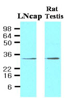 Cell lysates of LNcap (30ug) and Rat testis (30ug) were resolved by SDS-PAGE, transferred to NC membrane and probed with anti-human STEAP1 (1:500). Proteins were visualized using a goat anti-mouse secondary antibody conjugated to HRP and an ECL detection system.