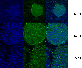 Immunofluorescence staining of human ES cell colony with monoclonal anti-human TRA1 antibody (2H3)