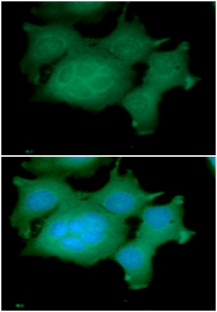 ICC/IF analysis of ADRM1 in MCF7 cells line, stained with DAPI (Blue) for nucleus staining and monoclonal anti-human   ADRM1 antibody (1:100) with goat anti-mouse IgG-Alexa fluor 488 conjugate (Green).