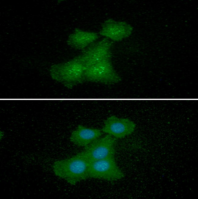 ICC/IF analysis of EIF5A in Balb/3T3 cells line, stained with DAPI (Blue) for nucleus staining and monoclonal anti-human   EIF5A antibody (1:100) with goat anti-mouse IgG-Alexa fluor 488 conjugate (Green)