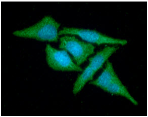 ICC/IF analysis of MAT2A in HeLa cells line, stained with DAPI (Blue) for nucleus staining and monoclonal anti-human    MAT2A antibody (1:100) with goat anti-mouse IgG-Alexa fluor 488 conjugate (Green).