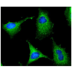 ICC/IF analysis of G6PD in HeLa cells line, stained with DAPI (Blue) for nucleus staining and monoclonal anti-human G6PD antibody (1:100) with goat anti-mouse IgG-Alexa fluor 488 conjugate (Green).