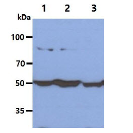 The Cell lysates (40ug) were resolved by SDS-PAGE, transferred to PVDF membrane and probed with anti-human G6PD antibody (1:1000). Proteins were visualized using a goat anti-mouse secondary antibody conjugated to HRP and an ECL detection system.Lane 1.: MCF cell lysateLane 2.: HeLa cell lysateLane 3.: Jurkat cell lysate